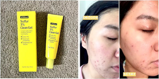 Wishtrend Sulfur 3% Gel Facial Cleanser for Oil Control & Soothing Action 30ml