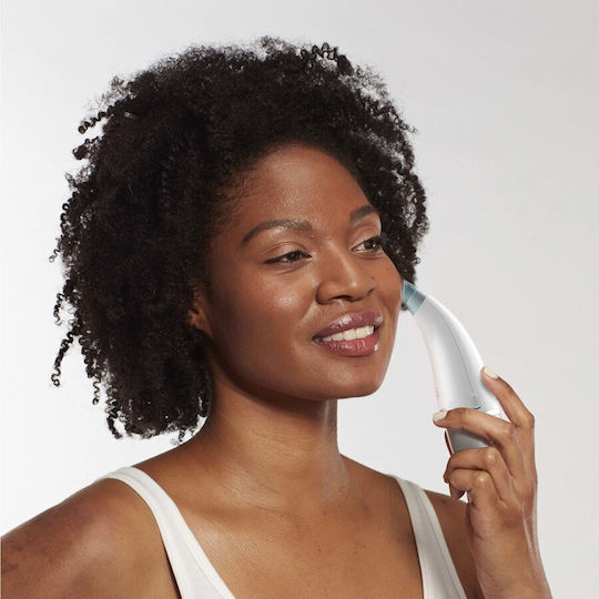 Homedics Aparat Facial cu Aspirare T-MLX53812