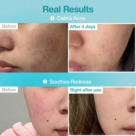 Numbuzin No.1 Pantothenic B5 Hyaluronic Active Clear Μάσκα Προσώπου 26ml