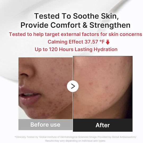 Hypochlorous 3H Relief Redness-Reducing Face Moisturizing Cream with Hyaluronic Acid & Aloe Vera 50ml