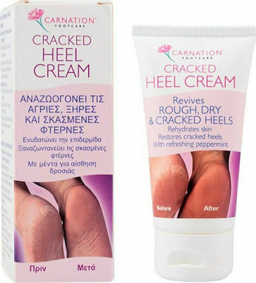 Carnation Carnation Cracked Heel Hidratantă Crema pentru Călcâie Crăpate cu Uree 50ml