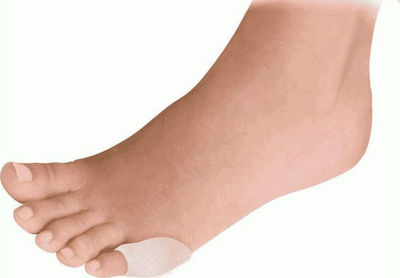 Herbi Feet Callus Gel Patch Small 1pcs