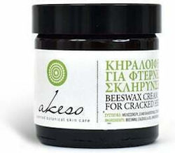 Akeso Beeswax cream for Cracked Heels Ενυδατική Κρέμα για Κάλους, Σκληρύνσεις & Σκασμένες Φτέρνες 60ml