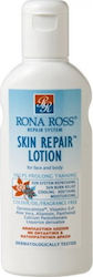 Rona Ross Skin Repair After Sun Lotion with Aloe Vera & Panthenol 160ml