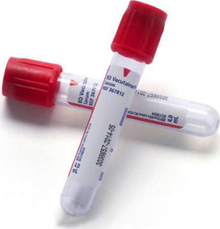 BD Vacutainer Plus Σωληνάρια Αιμοληψίας 10ml Σωληνάρια Αιμοληψίας 100τμχ 10ml