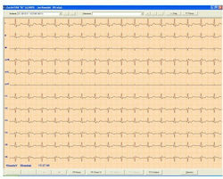 Λογισμικό Καρδιογράφων Aspel CardioTEKA