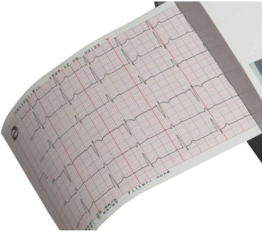 Edan MFM2 Cadence Χαρτί Καρδιογράφου 112x90mm Δεσμίδα με 150Φύλλα 5τμχ