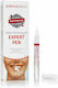 Beconfident Simplesmile Teeth Whitening X4 Expert Pen