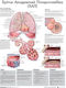 Ανατομικός Χάρτης: Χρόνια Αποφρακτική Πνευμονοπάθεια (ΧΑΠ)