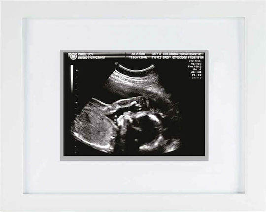 Pearhead Andenken Fotorahmen Für Babys