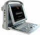 Chison ECO 5 + Doppler Transrectal Array R7-A Συσκευή Φορητού Υπερήχου
