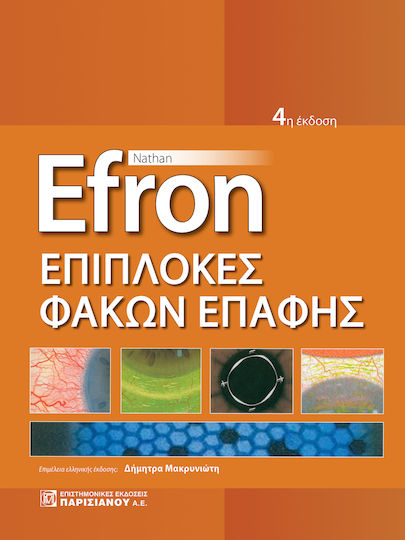 Επιπλοκες Φακων Επαφης