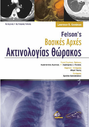 Felson's Βασικές Αρχές Ακτινολογίας Θώρακος