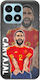 Euro 2024 Dani Carvajal Honor X8a Black Tpu Μαύρη Σιλικόνη