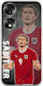 Euro 2024 Marcel Sabitzer Honor 70 5g Flexibles TPU Transparentes Silikon