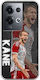 Football Stars Harry Kane Oppo Reno 8 Pro 5g Flexible Tpu Transparent Silicone