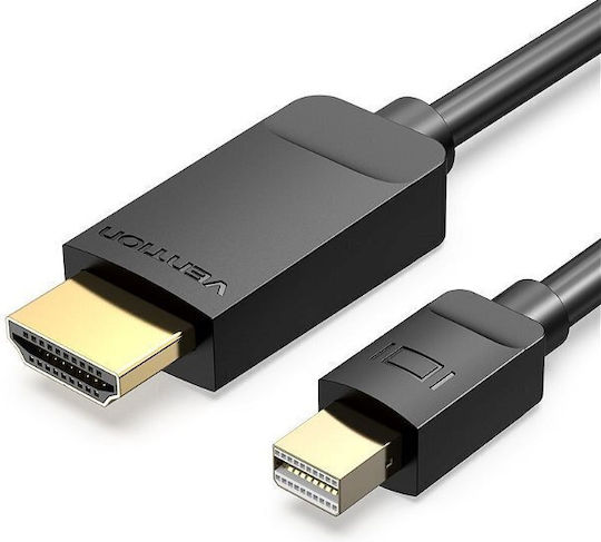 Vention DisplayPort-Kabel Männlich - Mini-DisplayPort Männlich 2m Schwarz