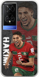 Football Stars Achraf Hakimi Morocco Tcl 50 5g Flexible TPU Transparent Silicone