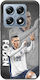 Euro 2024 Phil Foden Xiaomi 14t Pro 5g Black Tpu Μαύρη Σιλικόνη