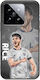 Euro 2024 Declan Rice Xiaomi 14t 5g Black Tpu Μαύρη Σιλικόνη