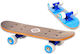 D'Arpeje Complete Shortboard Μπλε