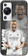 Fußballstars Kylian Mbappé Huawei P60 Pro Schwarzes TPU Schwarzes Silikon