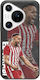 Football Stars Youssef El Arabi Huawei Pura 70 Pro Black Tpu Μαύρη Σιλικόνη