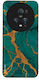 Sonique Marble Series Case for Honor Magic5 Pro...