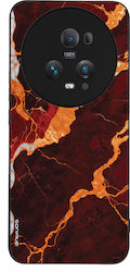 Sonique Marble Serie Hülle für Honor Magic5 Pro...