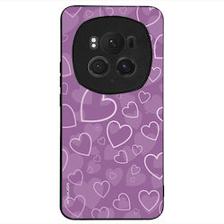 Sonique Heart Series Case for Honor Magic6 Pro ...