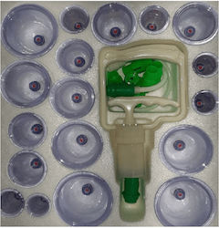Therapeutic Device Set Chinese Medicine 18 Suction Cups Kl Pull Out A Vacuum Apparatus