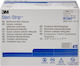 Steri Strip Wound Closure Strips 12 X 100mm