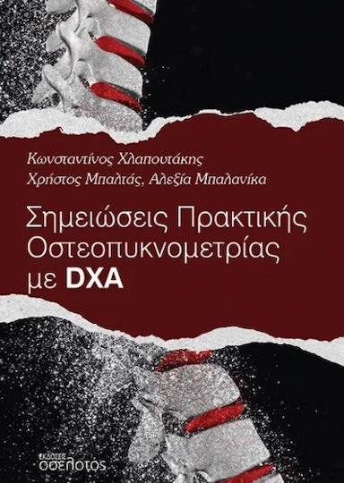 Σημειώσεις Πρακτικής Οστεοπυκνομετρίας Με Dxa
