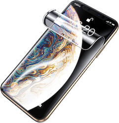 Infinity Enterprise Screen Protector (OnePlus Nord 2T)