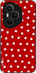 Sonique Heart Series Honor 400 Pro 5g Rote Hand...