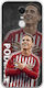 Football Stars Daniel Podence Xiaomi Redmi Note 4 Note 4x Flexible Tpu Διάφανη Σιλικόνη