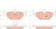 Trw Gdb1265 Brake Pad Set Disc Brake