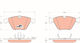 Trw Gdb1498 Brake Pad Set Disc Brake