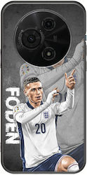 Euro 2024 Phil Foden Tcl 605 Black TPU Black Silicone Euro 2024 Phil Foden Tcl 605 Black TPU Black Silicone