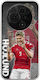 Euro 2024 Rasmus Hojlund Tcl 605 Flexible TPU Transparent Silicone