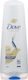 Dove Balsam 180ml