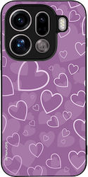Θήκη Sonique Heart Series Oppo Find X9 Pro 5g Β...