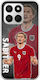 Euro 2024 Marcel Sabitzer Honor 400 Smart 5g Flexible TPU Transparent Silicone