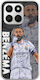 Football Stars Karim Benzema Honor 400 Smart 5g Гъвкав TPU Прозрачен Силикон