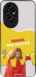 Sonique Back Cover Σιλικόνης (Honor 200)
