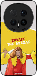 Sonique Силиконова Задна Корица Honor Magic8 Pro