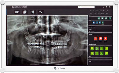 AG Neovo Medical Monitor