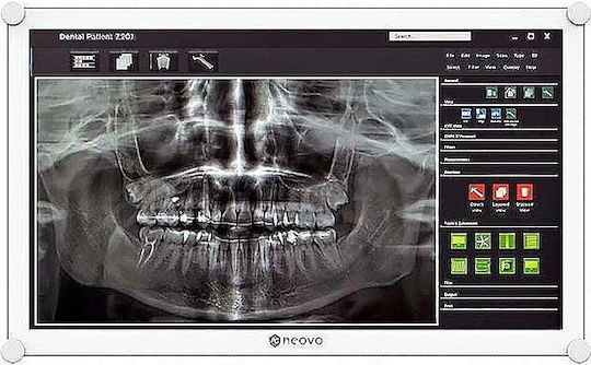 AG Neovo Monitor Medical