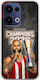 Kings Europe 2026 French Sniper Oppo Reno 13 5g Flexible TPU Transparent Silicone Case