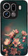 Sonique Case Sunset In Eden Series Oppo Find X9...